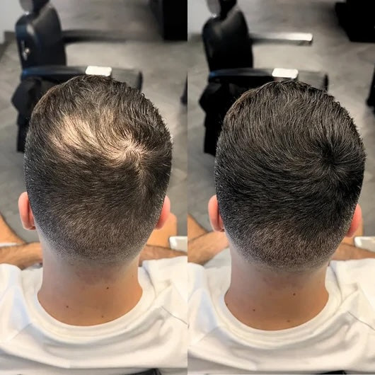 Döljande hårpuder för tunnhåriga