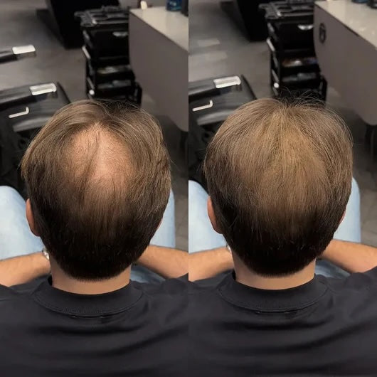 Döljande hårpuder för tunnhåriga