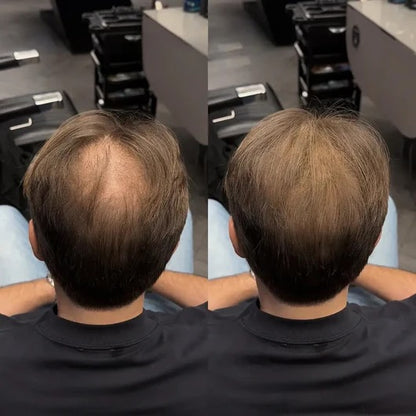 Döljande hårpuder för tunnhåriga