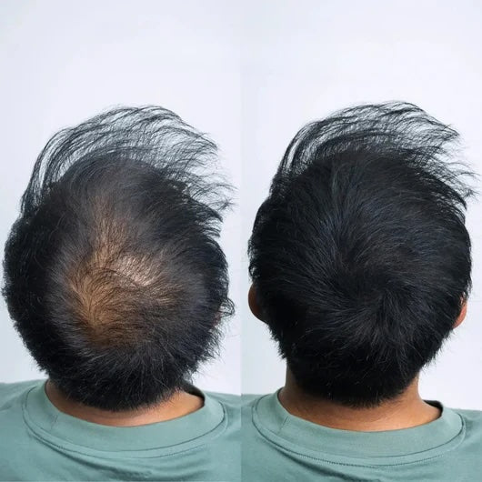 Döljande hårpuder för tunnhåriga