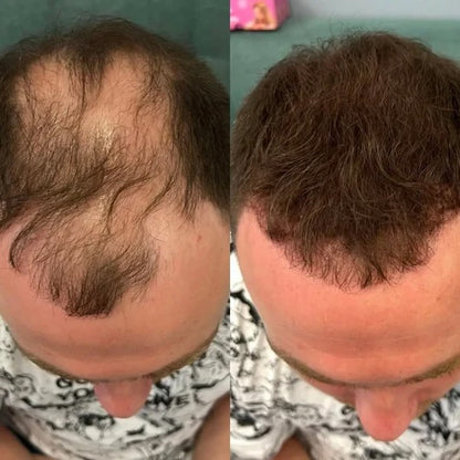 Döljande hårpuder för tunnhåriga